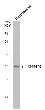 Rat tissue extract (50 μg) was separated by 7.5% SDS-PAGE, and the membrane was blotted with XPNPEP2 antibody [N2C2], Internal (GTX110170) diluted at 1:500. The HRP-conjugated anti-rabbit IgG antibody (GTX213110-01) was used to detect the primary antibody.