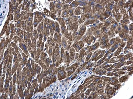 ALDH5A1 antibody [N1C1] detects ALDH5A1 protein at mitochondria in mouse liver by immunohistochemical analysis. Sample: Paraffin-embedded mouse liver. ALDH5A1 antibody [N1C1] (GTX110181) diluted at 1:500. 
 Antigen Retrieval: Citrate buffer, pH 6.0, 15 min