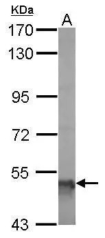 Sample (20 ug of whole cell lysate) A: mouse brain 7.5% SDS PAGE GTX110181 diluted at 1:5000