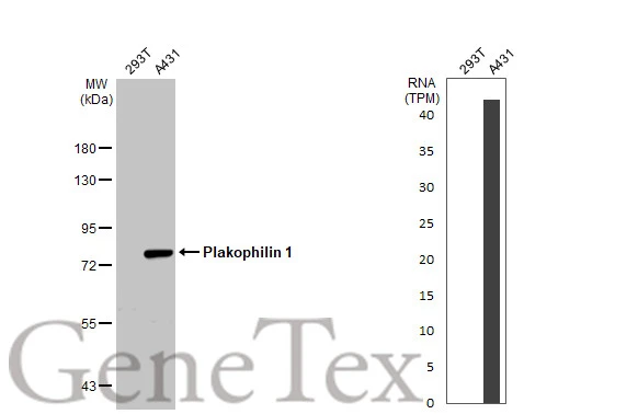 Various whole cell extracts (30 μg) were separated by 7.5% SDS-PAGE, and the membrane was blotted with Plakophilin 1 antibody [N2C1], Internal (GTX110201) diluted at 1:1000. The HRP-conjugated anti-rabbit IgG antibody (GTX213110-01) was used to detect the primary antibody. Corresponding RNA expression data for the same cell lines are based on Human Protein Atlas program.