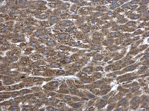 PLA2G4A antibody detects PLA2G4A protein at cytoplasm in mouse liver by immunohistochemical analysis. Sample: Paraffin-embedded mouse liver. PLA2G4A antibody (GTX110218) diluted at 1:500. 
 Antigen Retrieval: Citrate buffer, pH 6.0, 15 min