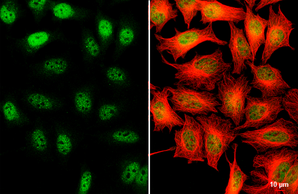 SETDB1 antibody [N2C1], Internal detects SETDB1 protein at nucleus by immunofluorescent analysis. Sample: HeLa cells were fixed in 4% paraformaldehyde at RT for 15 min. Green: SETDB1 stained by SETDB1 antibody [N2C1], Internal (GTX110219) diluted at 1:500. Red: alpha Tubulin, a cytoskeleton marker, stained by alpha Tubulin antibody [GT114] (GTX628802) diluted at 1:1000. Scale bar= 10μm.