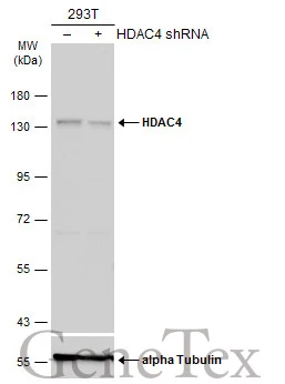 Non-transfected (–) and transfected (+) 293T whole cell extracts (60 μg) were separated by 7.5% SDS-PAGE, and the membrane was blotted with HDAC4 antibody [N3C1], Internal (GTX110231) diluted at 1:1000. The HRP-conjugated anti-rabbit IgG antibody (GTX213110-01) was used to detect the primary antibody.