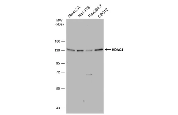 Various whole cell extracts (30 μg) were separated by 7.5% SDS-PAGE, and the membrane was blotted with HDAC4 antibody [N3C1], Internal (GTX110231) diluted at 1:1000. The HRP-conjugated anti-rabbit IgG antibody (GTX213110-01) was used to detect the primary antibody.