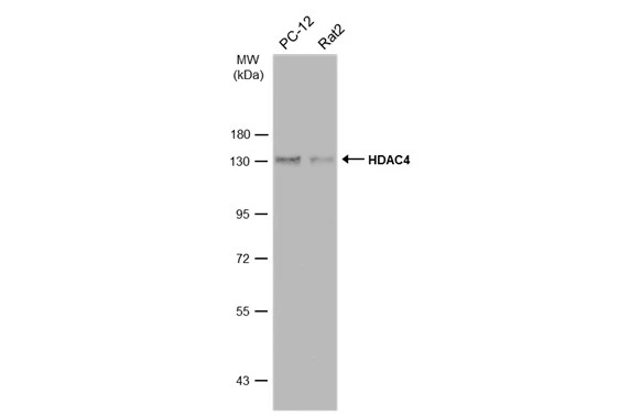 Various whole cell extracts (30 μg) were separated by 7.5% SDS-PAGE, and the membrane was blotted with HDAC4 antibody [N3C1], Internal (GTX110231) diluted at 1:1000. The HRP-conjugated anti-rabbit IgG antibody (GTX213110-01) was used to detect the primary antibody.