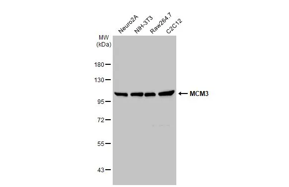 Various whole cell extracts (30 μg) were separated by 7.5% SDS-PAGE, and the membrane was blotted with MCM3 antibody (GTX110241) diluted at 1:500. The HRP-conjugated anti-rabbit IgG antibody (GTX213110-01) was used to detect the primary antibody. Various whole cell extracts (30 μg) were separated by 7.5% SDS-PAGE, and the membrane was blotted with MCM3 antibody (GTX110241) diluted at 1:500. The HRP-conjugated anti-rabbit IgG antibody (GTX213110-01) was used to detect the primary antibody.