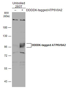 Non-transfected (–) and transfected (+) 293T whole cell extracts (30 μg) were separated by 7.5% SDS-PAGE, and the membrane was blotted with ATP6V0A2 antibody [N2C1], Internal (GTX110248) diluted at 1:5000. The HRP-conjugated anti-rabbit IgG antibody (GTX213110-01) was used to detect the primary antibody.