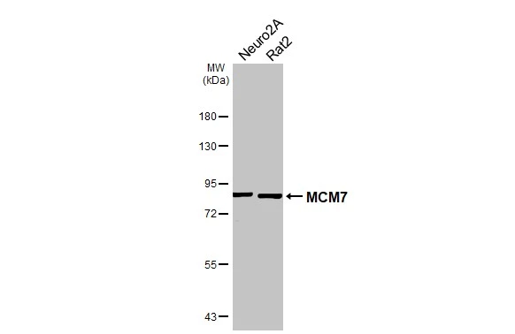 Various whole cell extracts (30 μg) were separated by 7.5% SDS-PAGE, and the membrane was blotted with MCM7 antibody [N2C2], Internal (GTX110278) diluted at 1:1000. The HRP-conjugated anti-rabbit IgG antibody (GTX213110-01) was used to detect the primary antibody.