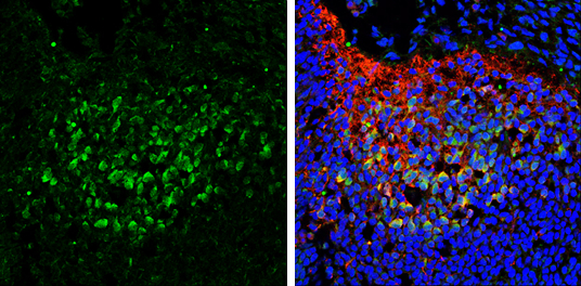 SAP102 antibody [C1C3] detects SAP102 protein expression by immunohistochemical analysis. Sample: Frozen sectioned E13.5 Rat brain. Green: SAP102 antibody [C1C3] stained by SAP102 antibody (GTX110289) diluted at 1:250. Red: beta Tubulin 3/ TUJ1, a mature neuron marker, stained by beta Tubulin 3/ TUJ1 antibody [GT11710] (GTX631836) diluted at 1:500. Blue: Fluoroshield with DAPI (GTX30920).