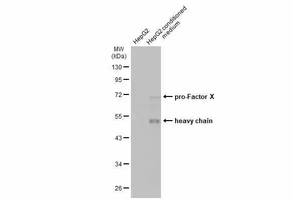 HepG2 whole cell extract and conditioned medium (30 μg) were separated by 10% SDS-PAGE, and the membrane was blotted with Factor X antibody (GTX110300) diluted at 1:1000. The HRP-conjugated anti-rabbit IgG antibody (GTX213110-01) was used to detect the primary antibody, and the signal was developed with Trident ECL plus-Enhanced.