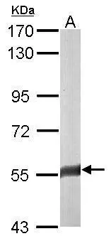 Sample (50 ug of whole cell lysate) A: mouse brain 7.5% SDS PAGE GTX110304 diluted at 1:3000 Sample (50 ug of whole cell lysate) A: mouse brain 7.5% SDS PAGE GTX110304 diluted at 1:3000