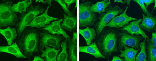 Cytokeratin 8 antibody detects Cytokeratin 8 protein at cytoskeleton by immunofluorescent analysis. Sample: HeLa cells were fixed in 4% paraformaldehyde at RT for 15 min. Green: Cytokeratin 8 stained by Cytokeratin 8 antibody (GTX110311) diluted at 1:500. Blue: Hoechst 33342 staining. Cytokeratin 8 antibody detects Cytokeratin 8 protein at cytoskeleton by immunofluorescent analysis. Sample: HeLa cells were fixed in 4% paraformaldehyde at RT for 15 min. Green: Cytokeratin 8 stained by Cytokeratin 8 antibody (GTX110311) diluted at 1:500. Blue: Hoechst 33342 staining.