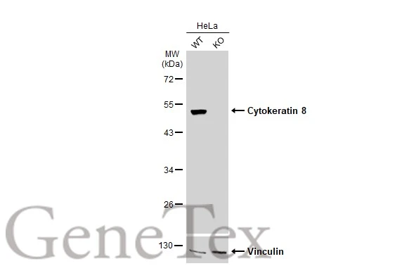 Wild-type (WT) and Cytokeratin 8 knockout (KO) HeLa cell extracts (30 μg) were separated by 10% SDS-PAGE, and the membrane was blotted with Cytokeratin 8 antibody (GTX110311) diluted at 1:20000. The HRP-conjugated anti-rabbit IgG antibody (GTX213110-01) was used to detect the primary antibody. Wild-type (WT) and Cytokeratin 8 knockout (KO) HeLa cell extracts (30 μg) were separated by 10% SDS-PAGE, and the membrane was blotted with Cytokeratin 8 antibody (GTX110311) diluted at 1:20000. The HRP-conjugated anti-rabbit IgG antibody (GTX213110-01) was used to detect the primary antibody.