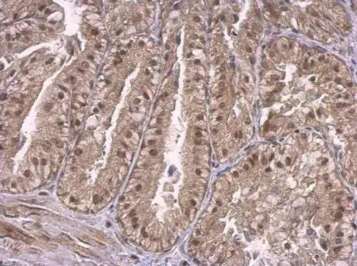 p130 antibody detects p130 protein at nucleus on mouse prostate by immunohistochemical analysis. Sample: Paraffin-embedded mouse prostate. p130 antibody (GTX110329) dilution: 1:500. 
 Antigen Retrieval: Trilogy? (EDTA based, pH 8.0) buffer, 15min