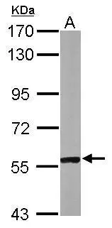 Sample (50 μg of whole cell lysate) A: mouse heart 7.5% SDS PAGE GTX110374 diluted at 1:1000 The HRP-conjugated anti-rabbit IgG antibody (GTX213110-01) was used to detect the primary antibody.