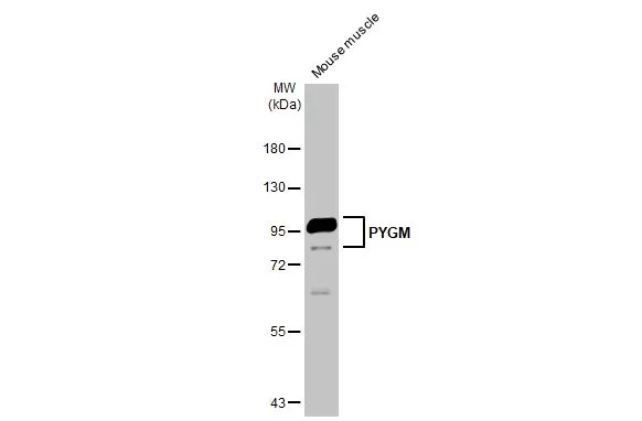 Mouse tissue extract (50 μg) was separated by 7.5% SDS-PAGE, and the membrane was blotted with PYGM antibody [C1C3] (GTX110411) diluted at 1:10000. The HRP-conjugated anti-rabbit IgG antibody (GTX213110-01) was used to detect the primary antibody.