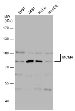 Various whole cell extracts (30 μg) were separated by 7.5% SDS-PAGE, and the membrane was blotted with MCM4 antibody (GTX110424) diluted at 1:2000.