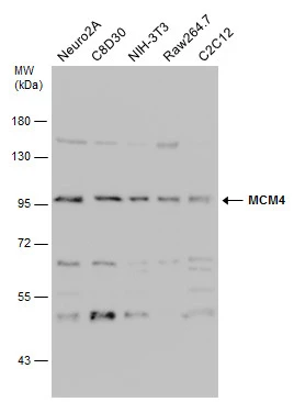 Various whole cell extracts (30 μg) were separated by 7.5% SDS-PAGE, and the membrane was blotted with MCM4 antibody (GTX110424) diluted at 1:2000. Various whole cell extracts (30 μg) were separated by 7.5% SDS-PAGE, and the membrane was blotted with MCM4 antibody (GTX110424) diluted at 1:2000.