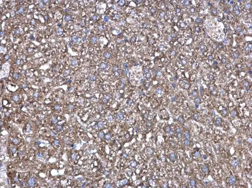 Factor XIIIa antibody [N1N3]