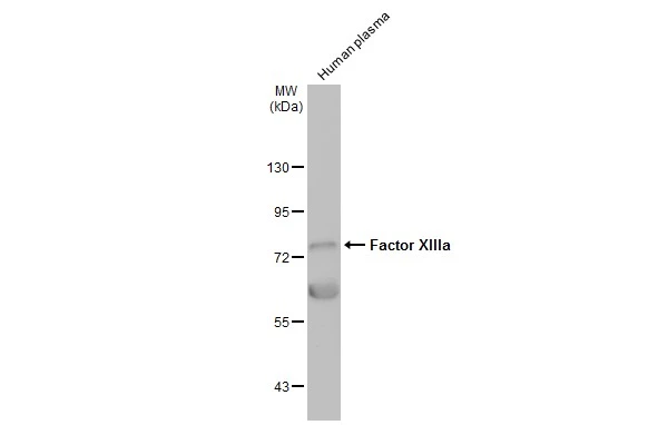 Factor XIIIa antibody [N1N3]