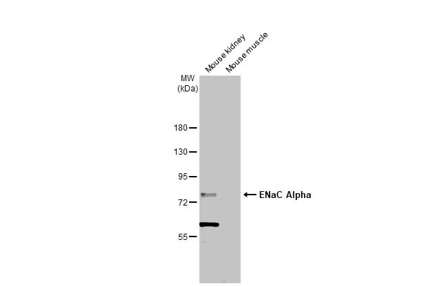 Various tissue extracts (50 μg) were separated by 7.5% SDS-PAGE, and the membrane was blotted with ENaC Alpha antibody [N3C2], Internal (GTX110436) diluted at 1:1000. The HRP-conjugated anti-rabbit IgG antibody (GTX213110-01) was used to detect the primary antibody.