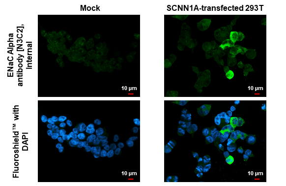 ENaC Alpha antibody [N3C2], Internal detects ENaC Alpha protein by immunofluorescent analysis. Sample: Mock and transfected 293T cells were fixed in 4% paraformaldehyde at RT for 15 min. Green: ENaC Alpha stained by ENaC Alpha antibody [N3C2], Internal (GTX110436) diluted at 1:500. Blue: Fluoroshield with DAPI (GTX30920).