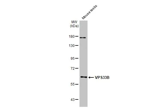 Mouse tissue extract (50 μg) was separated by 7.5% SDS-PAGE, and the membrane was blotted with VPS33B antibody [N3C2], Internal (GTX110467) diluted at 1:1000. The HRP-conjugated anti-rabbit IgG antibody (GTX213110-01) was used to detect the primary antibody, and the signal was developed with Trident ECL plus-Enhanced.