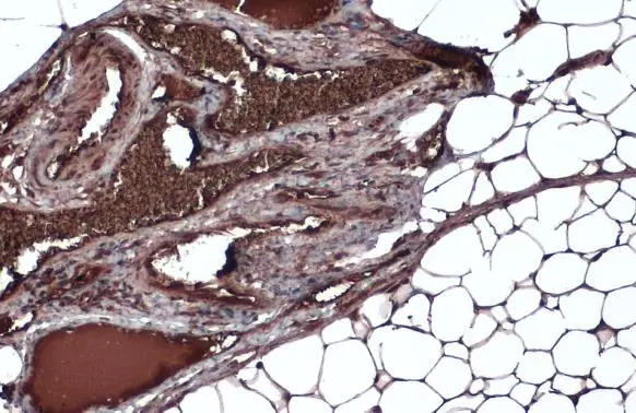 Fatty Acid Synthase antibody [N1N2], N-term detects Fatty Acid Synthase protein at cytoplasm by immunohistochemical analysis. Sample: Paraffin-embedded mouse adrenal gland. Fatty Acid Synthase stained by Fatty Acid Synthase antibody [N1N2], N-term (GTX110470) diluted at 1:500. Antigen Retrieval: Citrate buffer, pH 6.0, 15 min