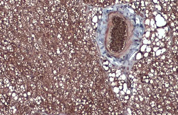Fatty Acid Synthase antibody [N1N2], N-term detects Fatty Acid Synthase protein at cytoplasm by immunohistochemical analysis. Sample: Paraffin-embedded mouse adrenal gland. Fatty Acid Synthase stained by Fatty Acid Synthase antibody [N1N2], N-term (GTX110470) diluted at 1:500. Antigen Retrieval: Citrate buffer, pH 6.0, 15 min