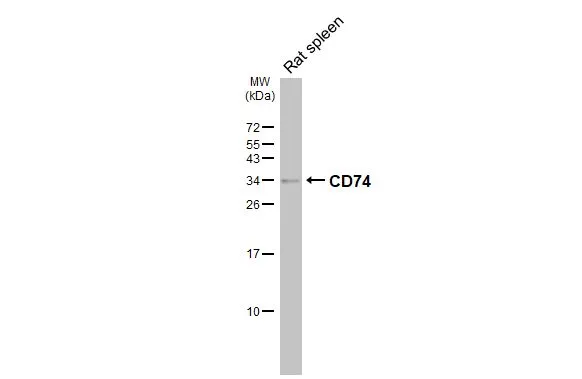 Rat tissue extract (50 μg) was separated by 15% SDS-PAGE, and the membrane was blotted with CD74 antibody [N1N2], N-term (GTX110477) diluted at 1:1000. The HRP-conjugated anti-rabbit IgG antibody (GTX213110-01) was used to detect the primary antibody, and the signal was developed with Trident ECL plus-Enhanced.