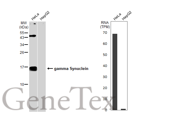 Various whole cell extracts (30 μg) were separated by 15% SDS-PAGE, and the membrane was blotted with gamma Synuclein antibody (GTX110483) diluted at 1:500. The HRP-conjugated anti-rabbit IgG antibody (GTX213110-01) was used to detect the primary antibody. Corresponding RNA expression data for the same cell lines are based on Human Protein Atlas program. Various whole cell extracts (30 μg) were separated by 15% SDS-PAGE, and the membrane was blotted with gamma Synuclein antibody (GTX110483) diluted at 1:500. The HRP-conjugated anti-rabbit IgG antibody (GTX213110-01) was used to detect the primary antibody. Corresponding RNA expression data for the same cell lines are based on Human Protein Atlas program.