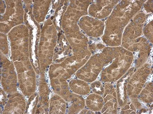 FRAT1 antibody [C2C3], C-term