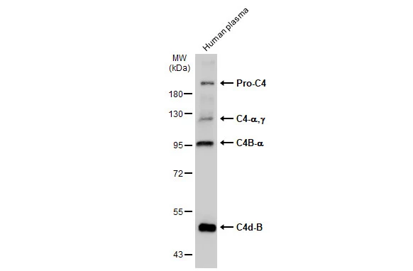 Human plasma (30 μg) was separated by 7.5% SDS-PAGE, and the membrane was blotted with C4 / C4d antibody [C2], C-term (GTX110502) diluted at 1:1000. The HRP-conjugated anti-rabbit IgG antibody (GTX213110-01) was used to detect the primary antibody.
