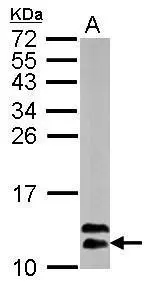 Sample (50 ug of whole cell lysate) A: mouse brain 15% SDS PAGE GTX110507 diluted at 1:1000 Sample (50 ug of whole cell lysate) A: mouse brain 15% SDS PAGE GTX110507 diluted at 1:1000
