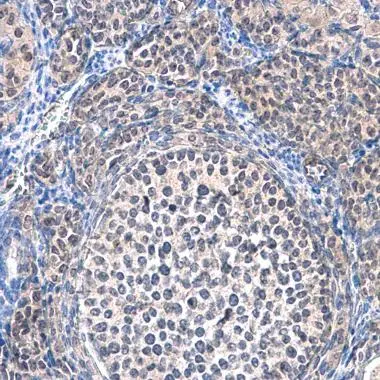 SMYD5 antibody [C2C3], C-term detects SMYD5 protein at cytoplasm and nucleus on mouse ovary by immunohistochemical analysis. Sample: Paraffin-embedded mouse ovary. SMYD5 antibody [C2C3], C-term (GTX110518) diluted at 1:500. 
 Antigen Retrieval: Trilogy? (EDTA based, pH 8.0) buffer, 15min