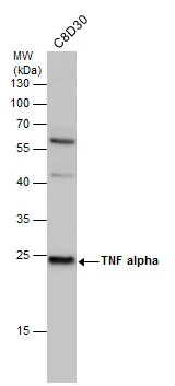 Anti-TNF alpha antibody (GTX110520) | GeneTex