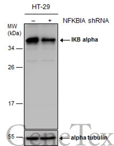 Non-transfected (–) and transfected (+) HT-29 whole cell extracts (30 μg) were separated by 12% SDS-PAGE, and the membrane was blotted with IKB alpha antibody (GTX110521) diluted at 1:1000. The HRP-conjugated anti-rabbit IgG antibody (GTX213110-01) was used to detect the primary antibody.