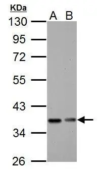 Non-transfected (�) and transfected (+) HT-29 whole cell extracts (30 ug) were separated by 12% SDS-PAGE,and the membrane was blotted with IKB alpha antibody (GTX110521) diluted at 1:1000.