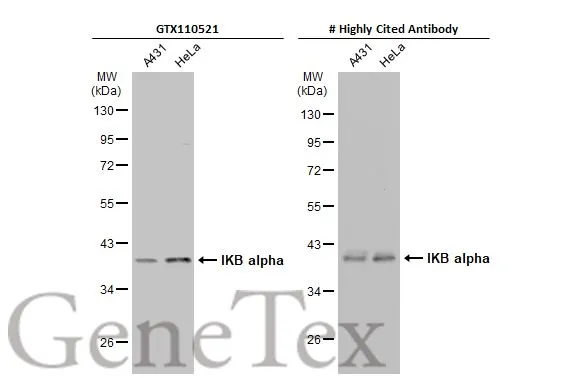 Anti-IKB alpha antibody (GTX110521) | GeneTex
