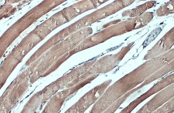 CSRP3 antibody detects CSRP3 protein at cytoplasm by immunohistochemical analysis. Sample: Paraffin-embedded mouse muscle. CSRP3 stained by CSRP3 antibody (GTX110536) diluted at 1:500. Antigen Retrieval: Citrate buffer, pH 6.0, 15 min