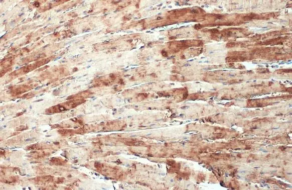 CSRP3 antibody detects CSRP3 protein at cytoplasm by immunohistochemical analysis. Sample: Paraffin-embedded mouse heart. CSRP3 stained by CSRP3 antibody (GTX110536) diluted at 1:500. Antigen Retrieval: Citrate buffer, pH 6.0, 15 min