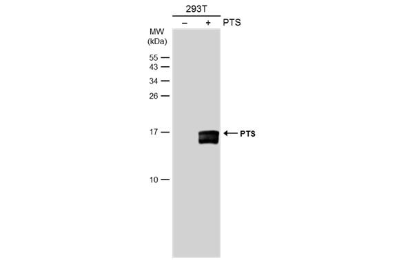 Non-transfected (–) and transfected (+) 293T whole cell extracts (30 μg) were separated by 15% SDS-PAGE, and the membrane was blotted with PTS antibody [N1C3] (GTX110549) diluted at 1:5000. The HRP-conjugated anti-rabbit IgG antibody (GTX213110-01) was used to detect the primary antibody.