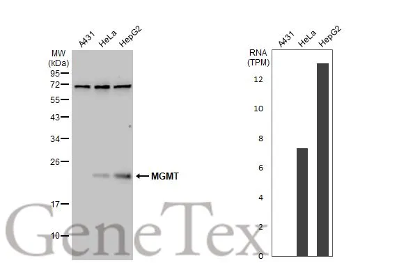 Various whole cell extracts (30 μg) were separated by 12% SDS-PAGE, and the membrane was blotted with MGMT antibody (GTX110551) diluted at 1:1000. The HRP-conjugated anti-rabbit IgG antibody (GTX213110-01) was used to detect the primary antibody. Corresponding RNA expression data for the same cell lines are based on Human Protein Atlas program.