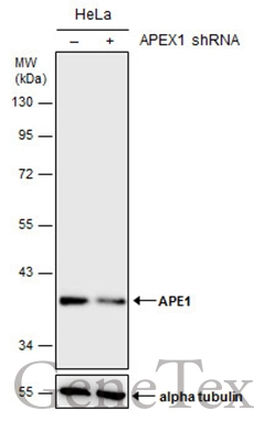 APE1 antibody detects APE1 protein at cytoplasm,nucleus and nucleolus on human ovarian carcinoma by immunohistochemical analysis.