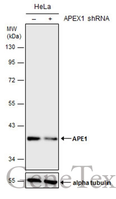 Non-transfected (–) and transfected (+) HeLa whole cell extracts (30 μg) were separated by 10% SDS-PAGE, and the membrane was blotted with APE1 antibody (GTX110558) diluted at 1:1000. The HRP-conjugated anti-rabbit IgG antibody (GTX213110-01) was used to detect the primary antibody.