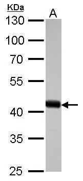 Various whole cell extracts were separated by 10% SDS-PAGE,and the membrane was blotted with beta Actin antibody (GTX110564) diluted at 1:10000.The HRP-conjugated anti-rabbit IgG antibody (GTX213110-01) was used to detect the primary antibody.