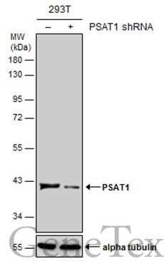 Non-transfected (–) and transfected (+) 293T whole cell extracts (30 μg) were separated by 10% SDS-PAGE, and the membrane was blotted with PSAT1 antibody [N1C3] (GTX110576) diluted at 1:1000. The HRP-conjugated anti-rabbit IgG antibody (GTX213110-01) was used to detect the primary antibody.