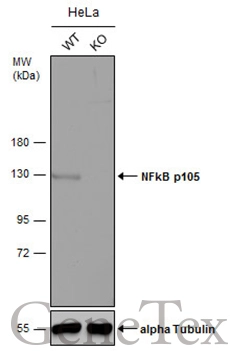 Wild-type (WT) and NFkB p105 knockout (KO) HeLa cell extracts (30 μg) were separated by 7.5% SDS-PAGE, and the membrane was blotted with NFkB p105 antibody (GTX110585) diluted at 1:1000. The HRP-conjugated anti-rabbit IgG antibody (GTX213110-01) was used to detect the primary antibody.
