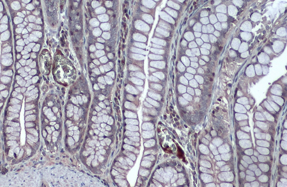 NFkB p105 antibody detects secreted NFkB p105 protein by immunohistochemical analysis. Sample: Paraffin-embedded dog colon. NFkB p105 stained by NFkB p105 antibody (GTX110585) diluted at 1:500. Antigen Retrieval: Citrate buffer, pH 6.0, 15 min