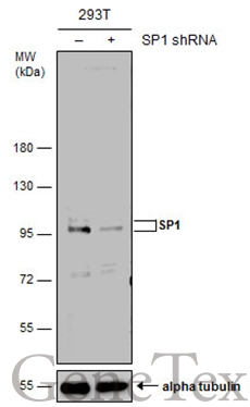 Non-transfected (–) and transfected (+) 293T whole cell extracts (50 μg) were separated by 7.5% SDS-PAGE, and the membrane was blotted with SP1 antibody (GTX110593) diluted at 1:10000. The HRP-conjugated anti-rabbit IgG antibody (GTX213110-01) was used to detect the primary antibody, and the signal was developed with Trident ECL plus-Enhanced.